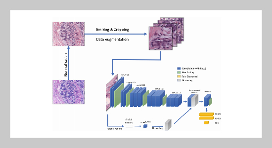 Classification of Histopathological Images for Early Detection of Breast Cancer Using Deep Learning