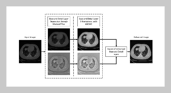 Improving visual quality of CT Images through enhancement of base and detail layers