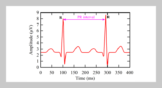 Using Electrocardiogram Signal Features and Heart Rate Variability to Predict Epileptic Attacks